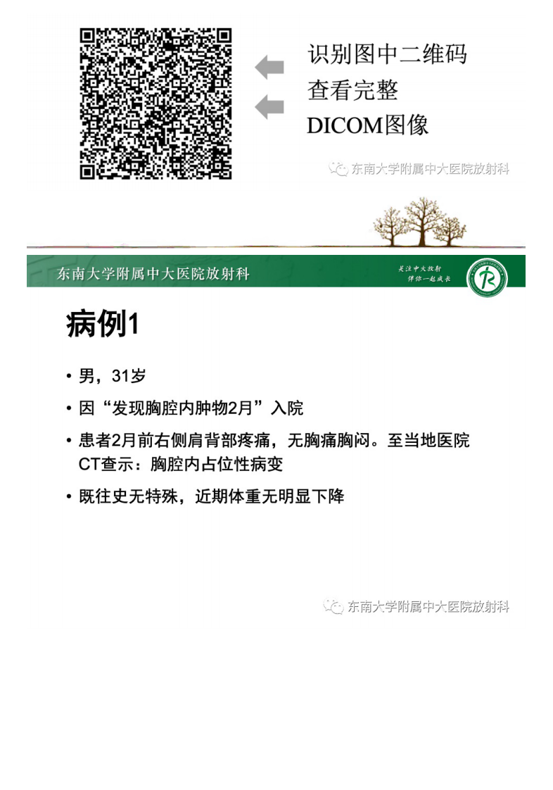 20210428_2【晨读结果公布】2021.04.28胸部疾病——前纵隔淋巴瘤.pdf 第2页