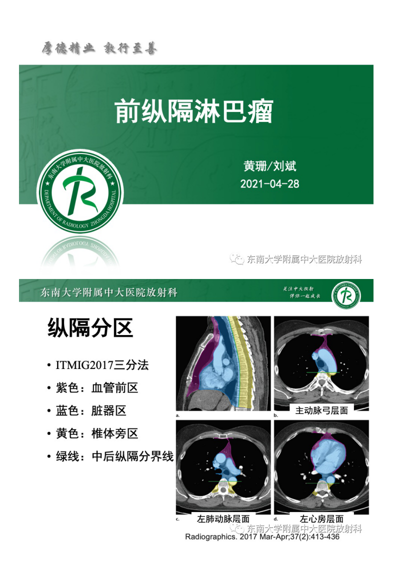 20210428_2【晨读结果公布】2021.04.28胸部疾病——前纵隔淋巴瘤.pdf 第5页