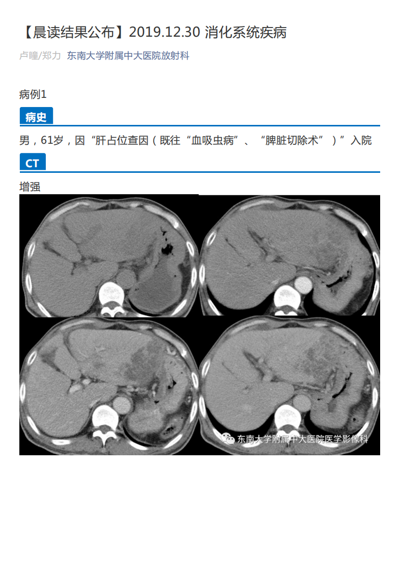 20191230_2【晨读结果公布】2019.12.30消化系统疾病.pdf 第1页
