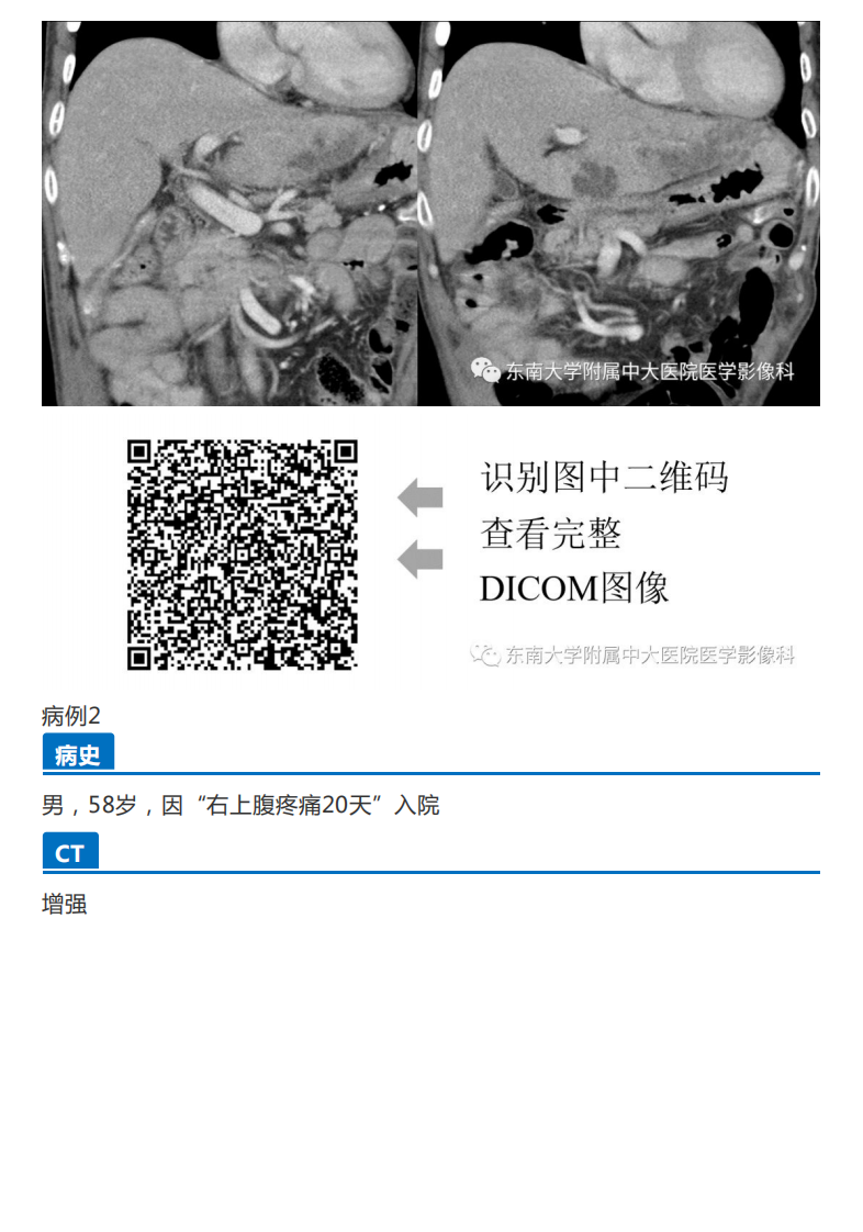 20191230_2【晨读结果公布】2019.12.30消化系统疾病.pdf 第2页