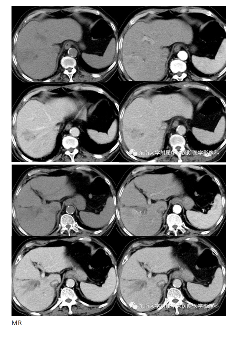 20191230_2【晨读结果公布】2019.12.30消化系统疾病.pdf 第5页