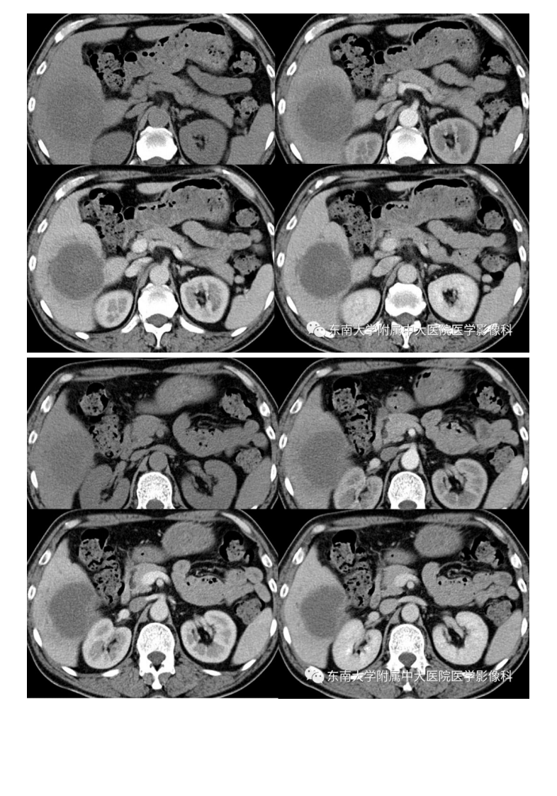 20191230_2【晨读结果公布】2019.12.30消化系统疾病.pdf 第3页