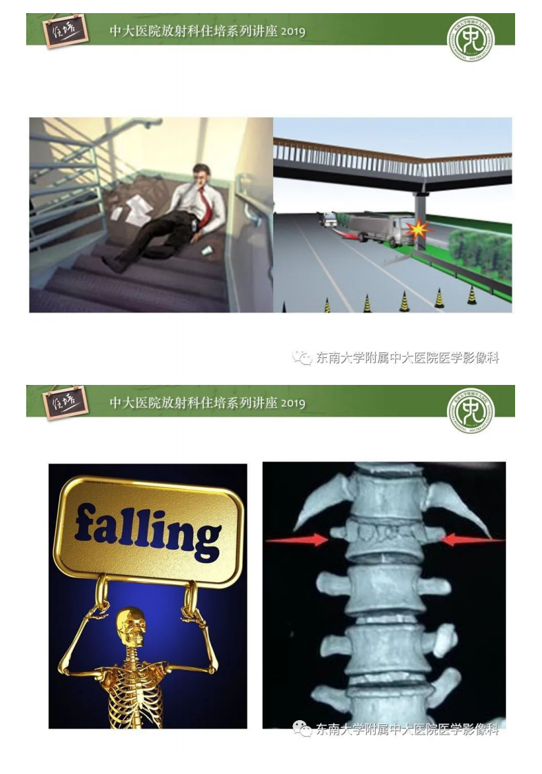 20200309_1【中大放射住培系列讲座】脊柱损伤.pdf 第2页