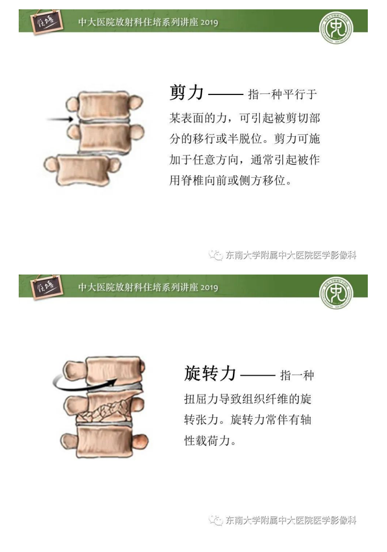20200309_1【中大放射住培系列讲座】脊柱损伤.pdf 第5页