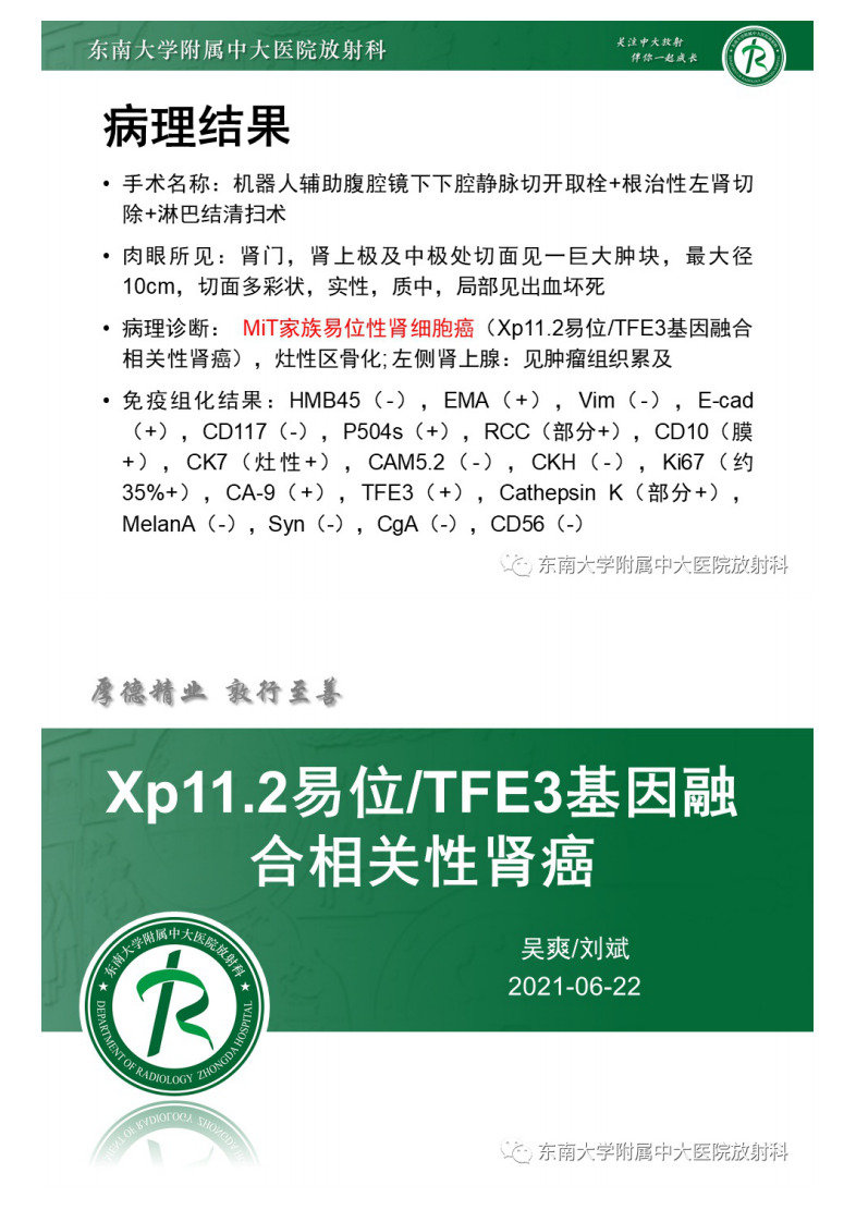 20210622_2【晨读结果公布】2021.06.22泌尿系统疾病——Xp11.2易位TFE3基因融合相关性肾癌.pdf 第4页