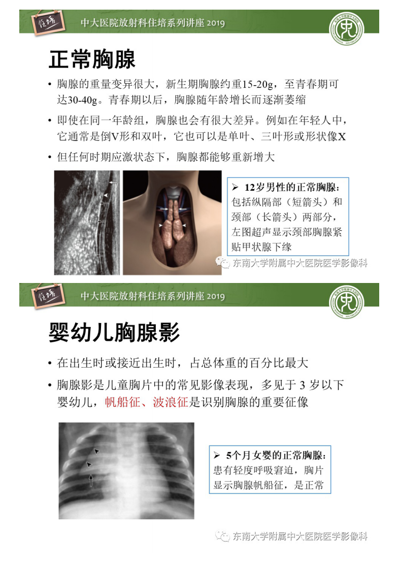 20200408_1【中大放射住培系列讲座】胸腺上皮性肿瘤的影像诊断及鉴别.pdf 第3页
