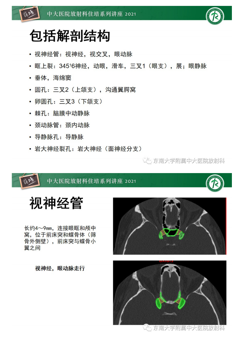 20210328_1【中大放射住培系列讲座】中颅窝底解剖结构及常见骨折征象.pdf 第4页