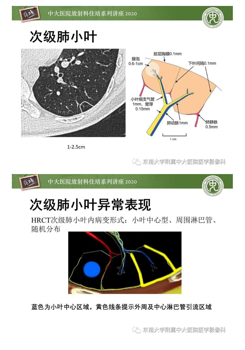 20200719_1【中大放射住培系列讲座】细支气管炎影像表现.pdf 第4页