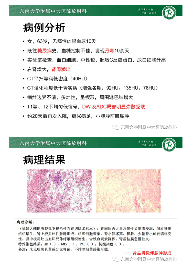 20210222_2【晨读结果公布】2021.02.22泌尿系统疾病——肾盂肾炎.pdf 第3页