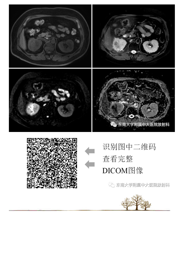 20210222_2【晨读结果公布】2021.02.22泌尿系统疾病——肾盂肾炎.pdf 第2页
