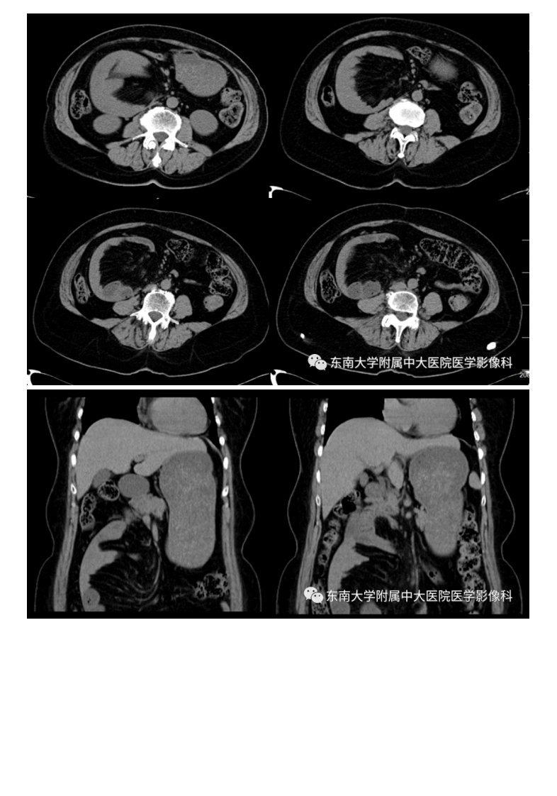 20201014_2【晨读结果公布】2020.10.14消化系统疾病——腹内疝.pdf 第2页