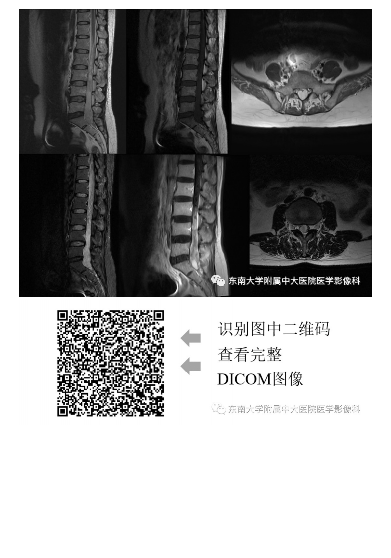 20201130_3【晨读结果公布】2020.11.30神经系统疾病——马尾终丝髓外硬膜下肿瘤诊断思路.pdf 第3页