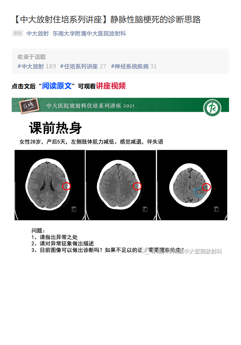20210506_1【中大放射住培系列讲座】静脉性脑梗死的诊断思路.pdf 第1页