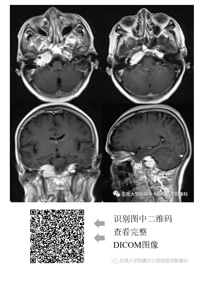 20190930_3【晨读结果公布】2019.09.29头颈部系统疾病.pdf 第5页