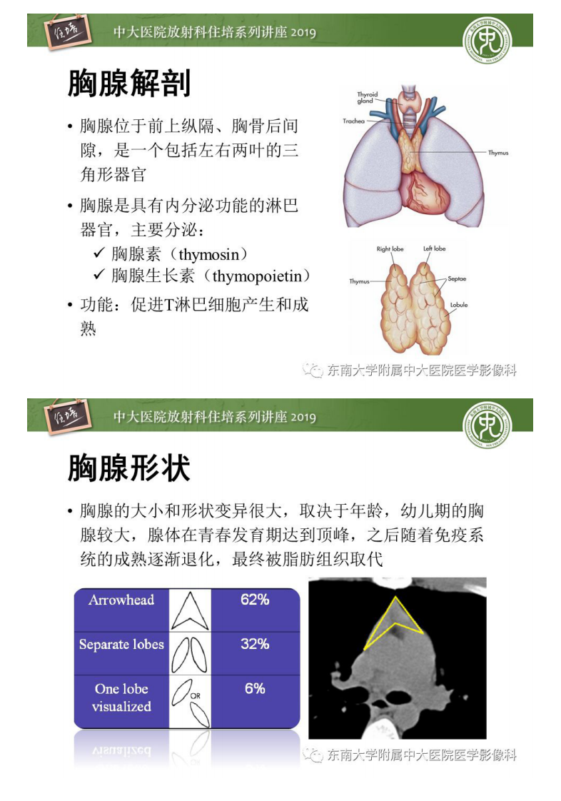 20190922_1【2019住培系列讲座第78期】胸腺上皮性肿瘤的影像诊断及鉴别.pdf 第2页