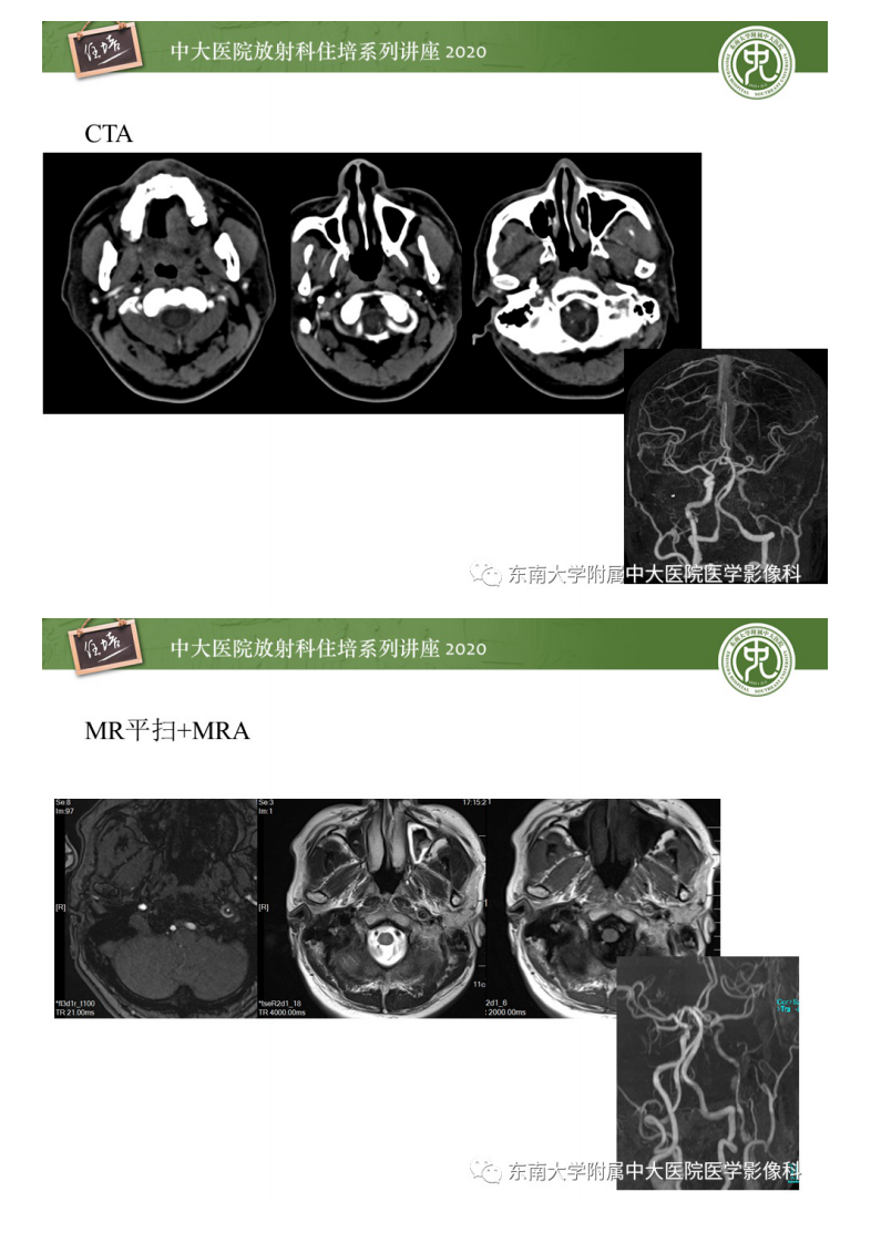 20200419_1【中大放射住培系列讲座】颈动脉夹层及夹层动脉瘤的影像诊断及评估.pdf 第3页