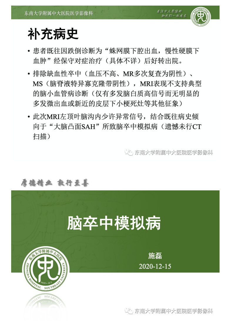 20201216_2【晨读结果公布】2020.12.15神经系统疾病——脑卒中模拟病.pdf 第4页