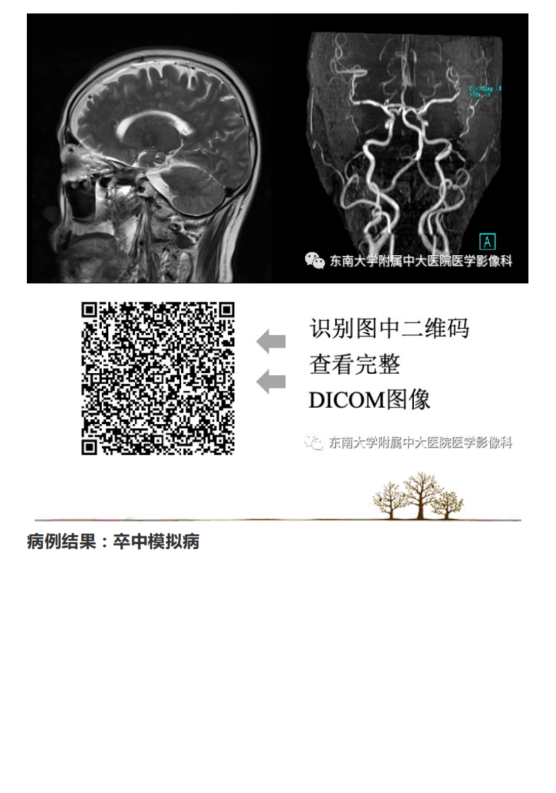 20201216_2【晨读结果公布】2020.12.15神经系统疾病——脑卒中模拟病.pdf 第3页