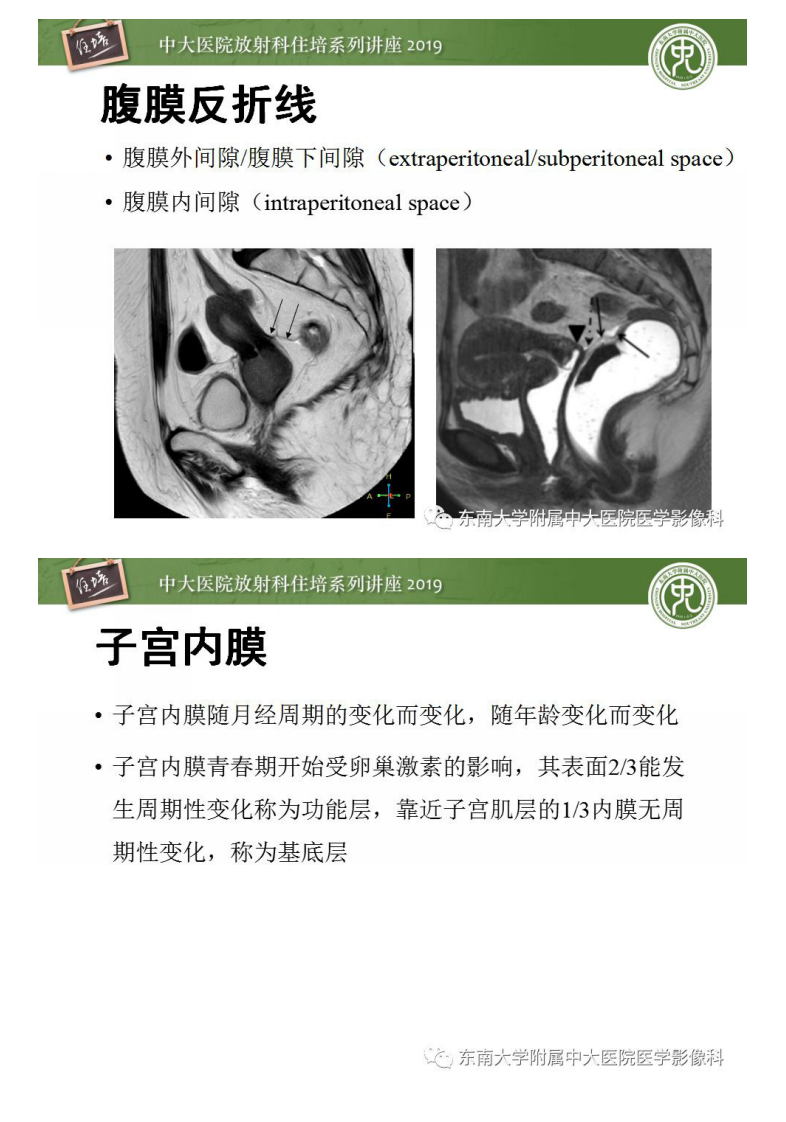 20190303_1【中大放射住培系列讲座第51期】子宫影像解剖及相关MR信号分析.pdf 第5页