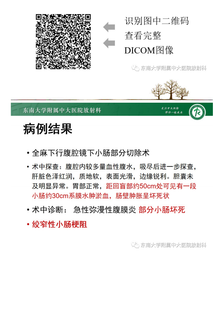 20210530_2【晨读结果公布】2021.05.28消化系统疾病——绞窄性肠梗阻.pdf 第2页
