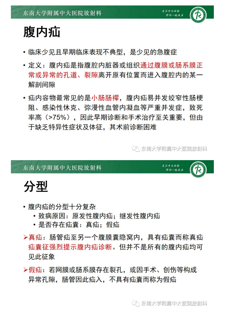 20210530_2【晨读结果公布】2021.05.28消化系统疾病——绞窄性肠梗阻.pdf 第4页