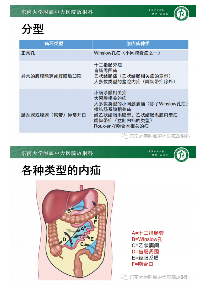 20210530_2【晨读结果公布】2021.05.28消化系统疾病——绞窄性肠梗阻.pdf 第5页