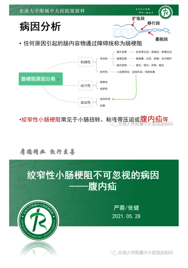 20210530_2【晨读结果公布】2021.05.28消化系统疾病——绞窄性肠梗阻.pdf 第3页