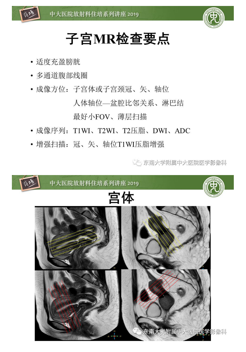 20200204_1【中大放射住培系列讲座】子宫影像解剖及相关MR信号分析.pdf 第3页