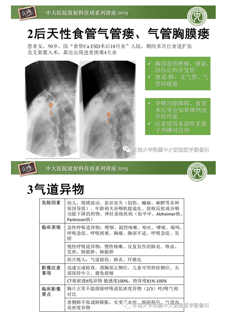 20200401_1【中大放射住培系列讲座】呼吸系统急症影像解读.pdf 第4页