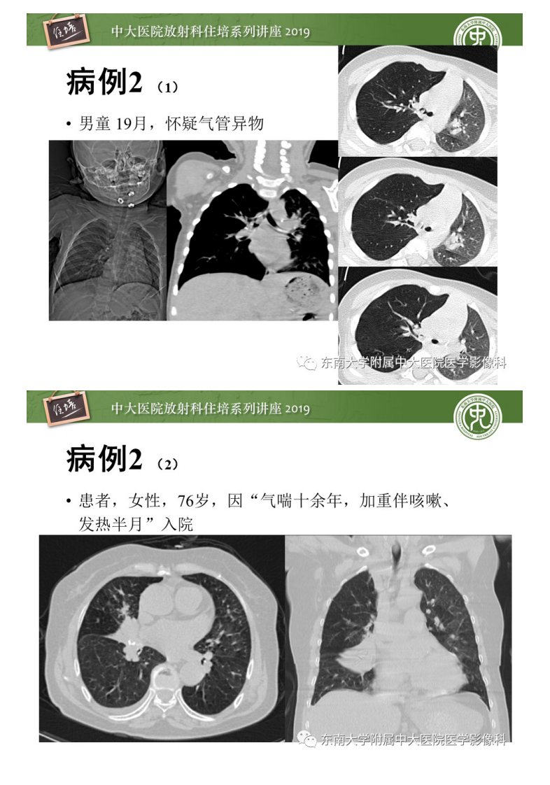 20200401_1【中大放射住培系列讲座】呼吸系统急症影像解读.pdf 第5页