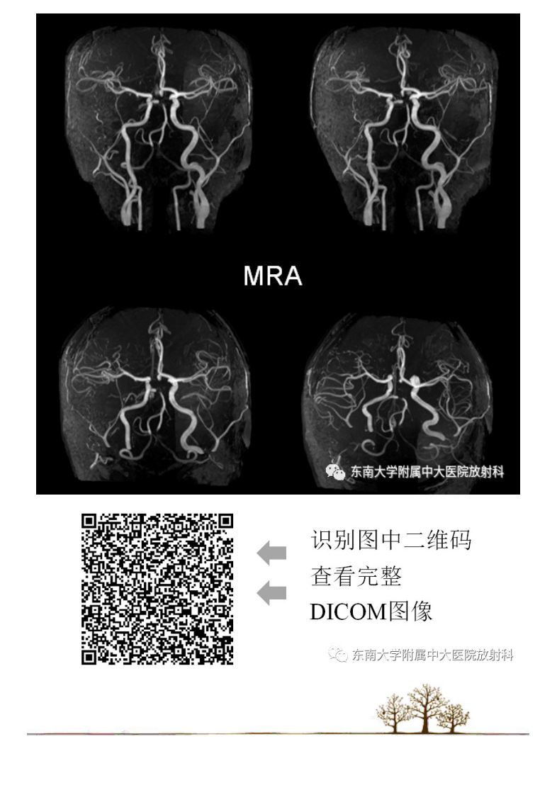 20210509_3【晨读结果公布】2021.05.08神经系统疾病——基底动脉尖综合征.pdf 第4页