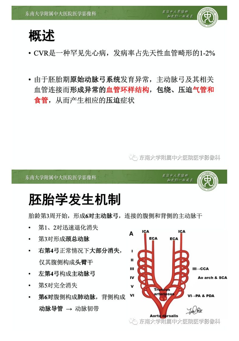 20201227_2【晨读结果公布】2020.12.25循环系统疾病——先天性血管环.pdf 第3页