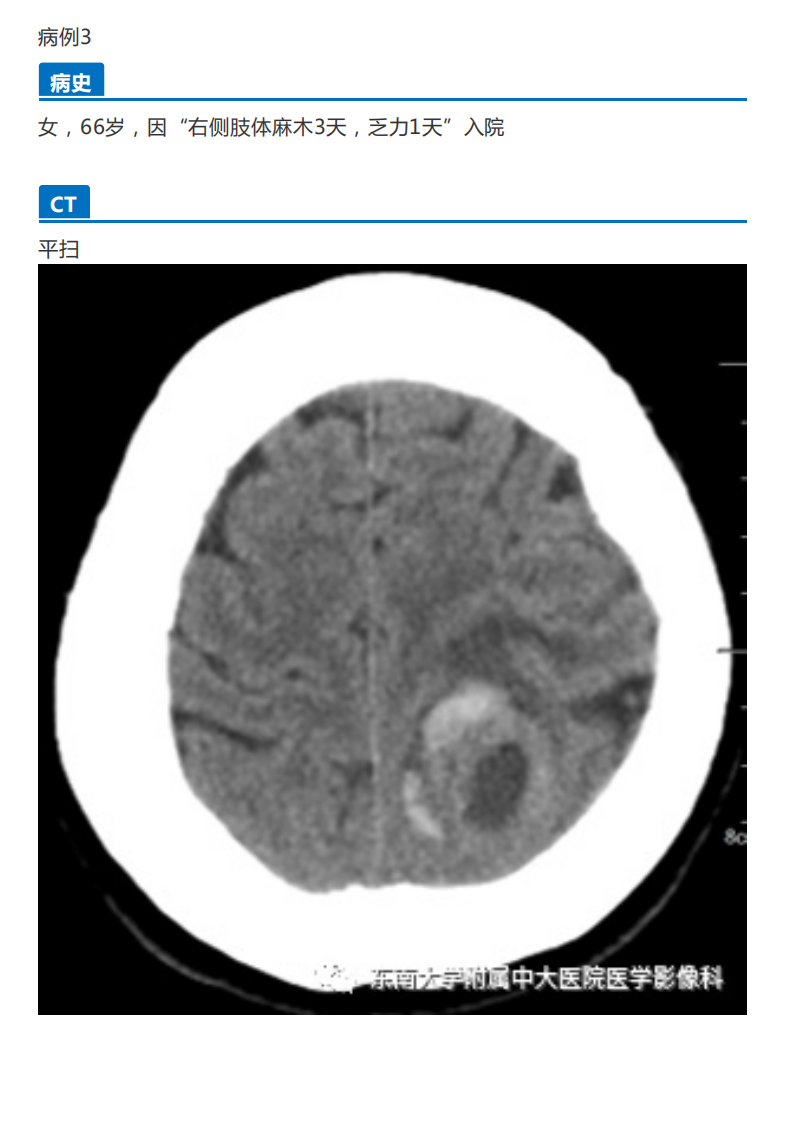 20190909_2【晨读结果公布】2019.09.09神经系统疾病.pdf 第5页