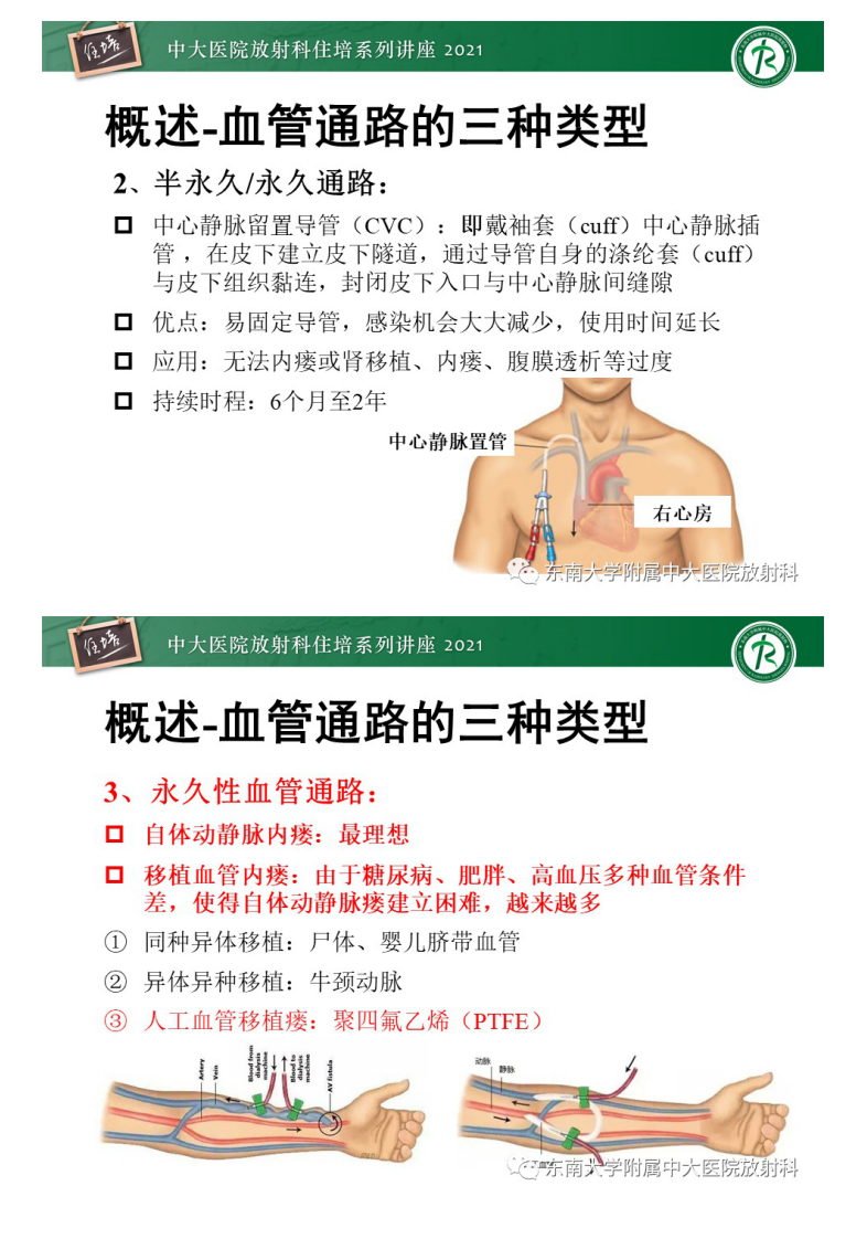 20210124_1【中大放射住培系列讲座】上肢动静脉解剖及人工动静脉造瘘术后CTA影像评估.pdf 第4页