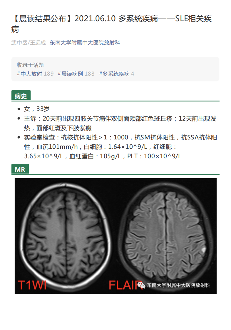 20210611_2【晨读结果公布】2021.06.10多系统疾病——SLE相关疾病.pdf 第1页