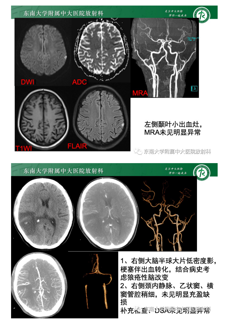 20210611_2【晨读结果公布】2021.06.10多系统疾病——SLE相关疾病.pdf 第4页