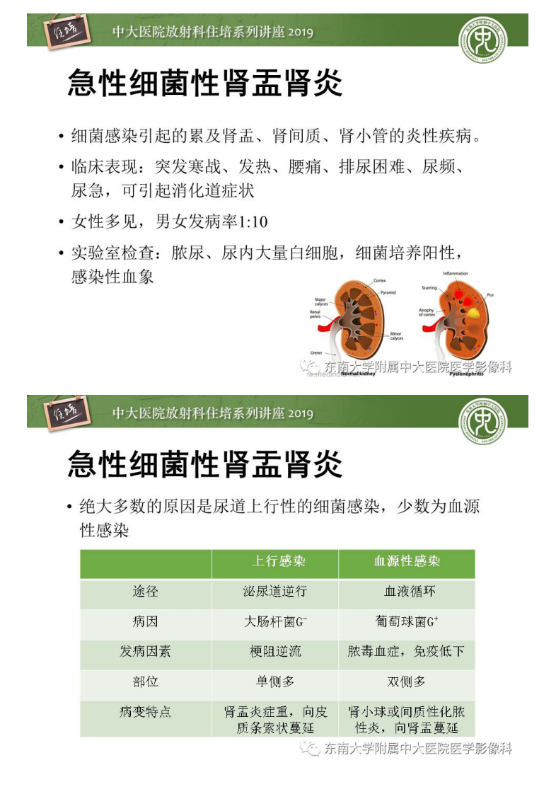20190811_1【中大放射住培系列讲座第73期】肾脏感染性病变的影像学表现.pdf 第5页