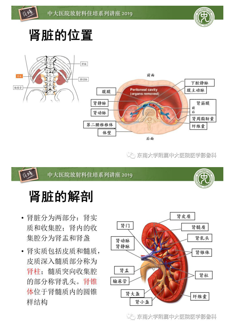 20190811_1【中大放射住培系列讲座第73期】肾脏感染性病变的影像学表现.pdf 第2页