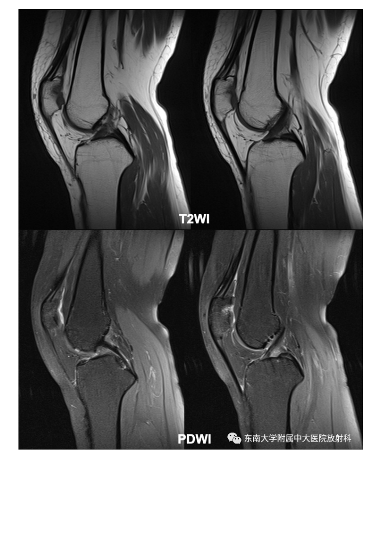 20210506_3【晨读结果公布】2021.05.06肌骨系统疾病——髌骨软化症.pdf 第4页