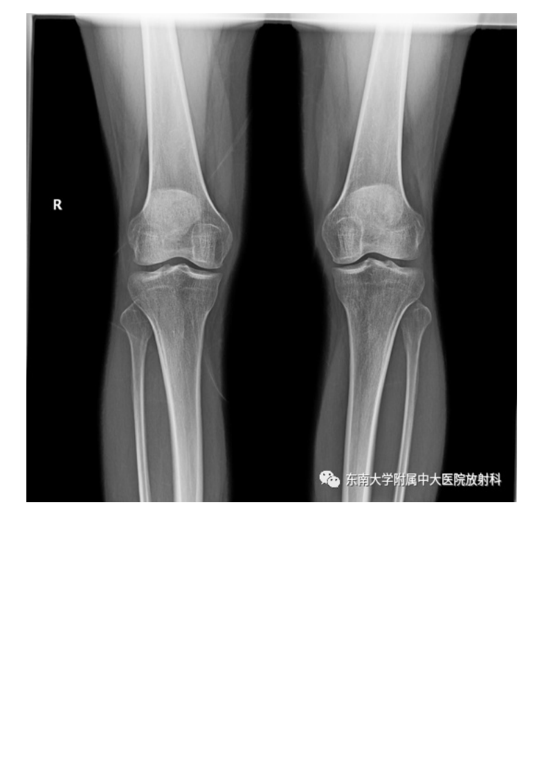 20210506_3【晨读结果公布】2021.05.06肌骨系统疾病——髌骨软化症.pdf 第2页