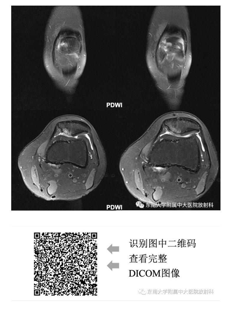 20210506_3【晨读结果公布】2021.05.06肌骨系统疾病——髌骨软化症.pdf 第5页
