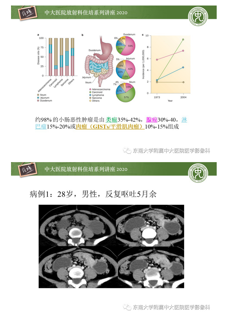 20200627_1【中大放射住培系列讲座】小肠恶性肿瘤的影像诊断思路.pdf 第3页