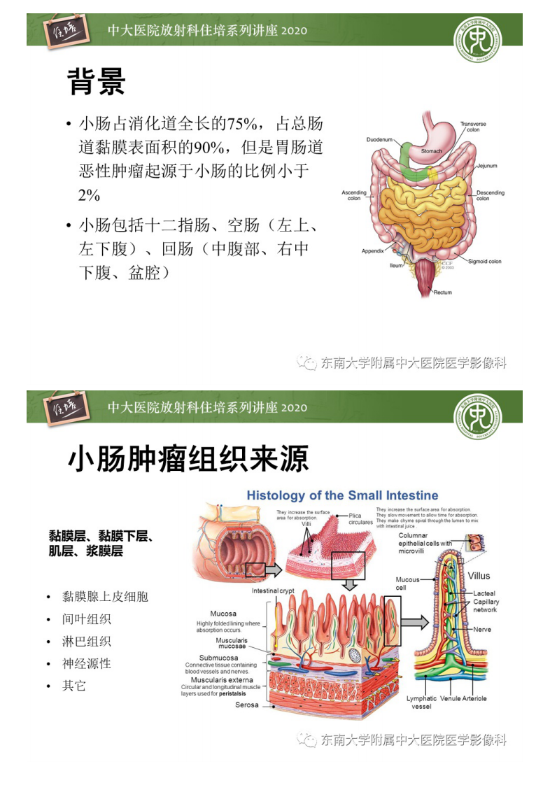 20200627_1【中大放射住培系列讲座】小肠恶性肿瘤的影像诊断思路.pdf 第2页