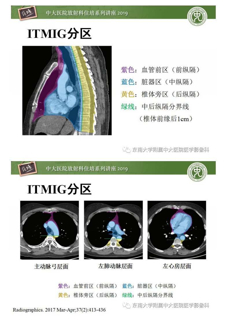 20190128_1【2018住培系列讲座第47期】纵隔分区及常见纵隔占位的影像诊断.pdf 第4页