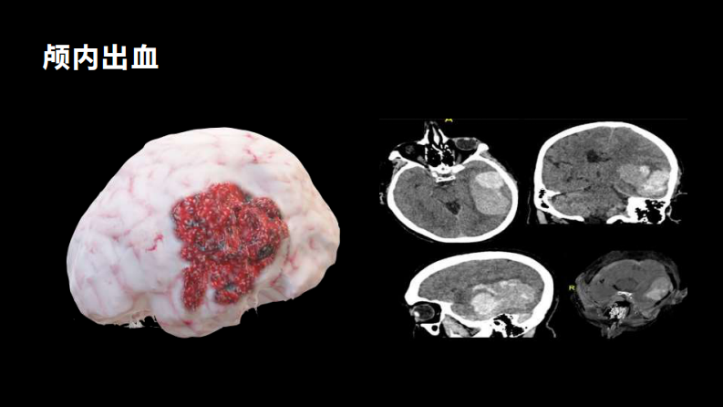 20240403-骨科智能.pdf 第4页