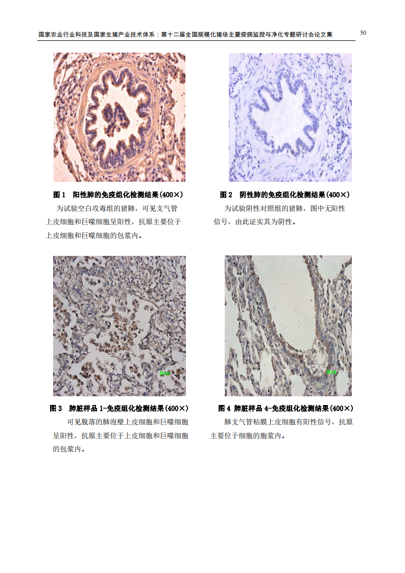 利用单抗免疫组化技术检测猪肺炎支原体.pdf 第3页