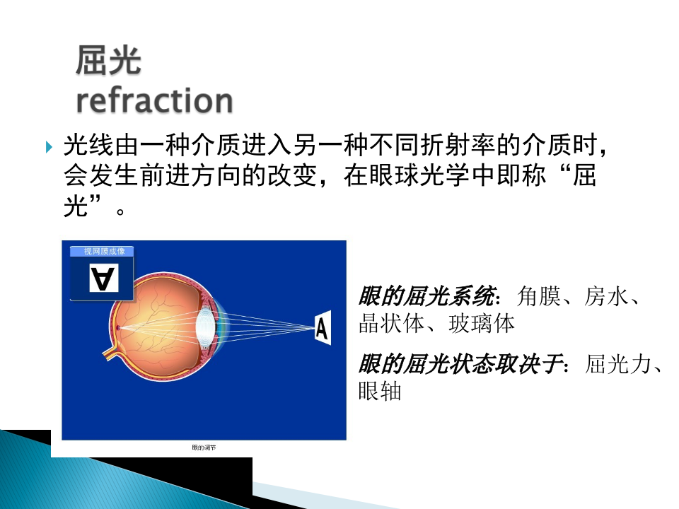 14)屈光不正.pptx 第5页