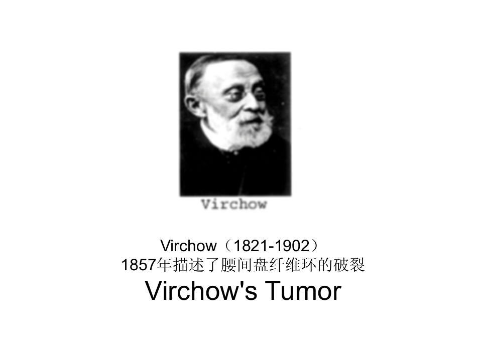 22)椎间盘突出  腰间盘突出.ppt 第4页