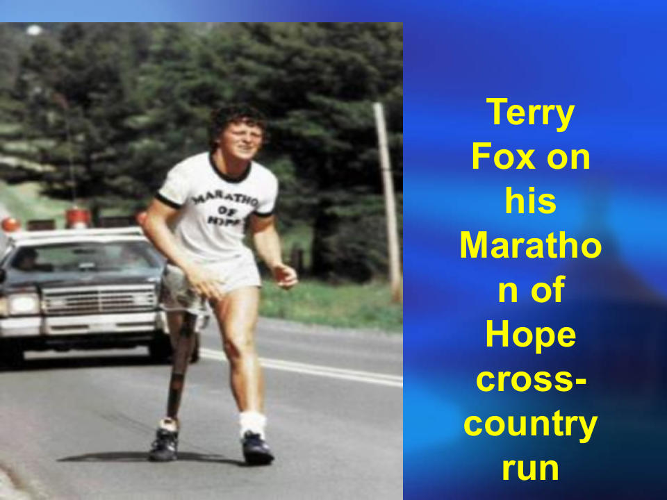 25)骨肿瘤课件.ppt 第3页