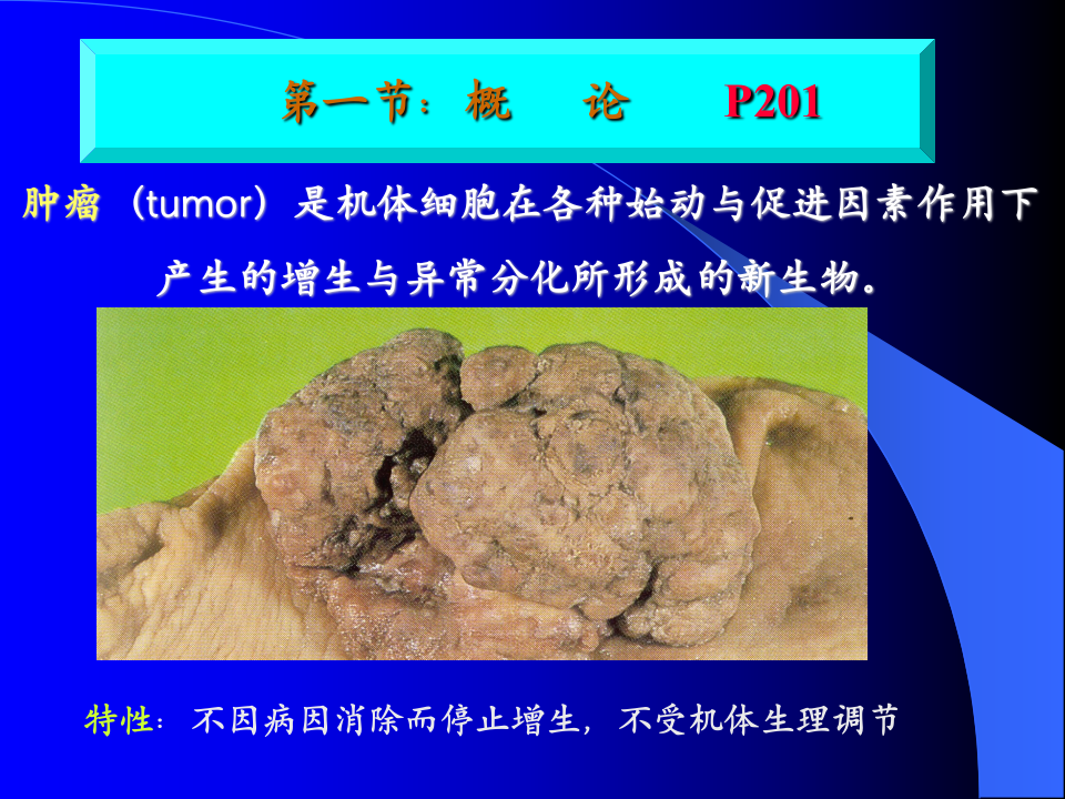 肿瘤正式!.ppt 第2页